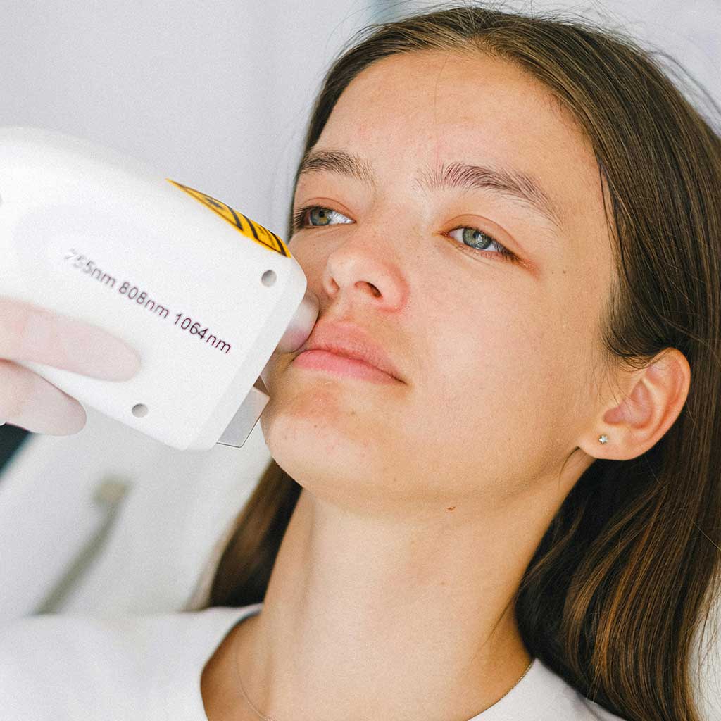 A woman undergoes a laser treatment on her upper lip, with a technician holding a handheld device to her face.