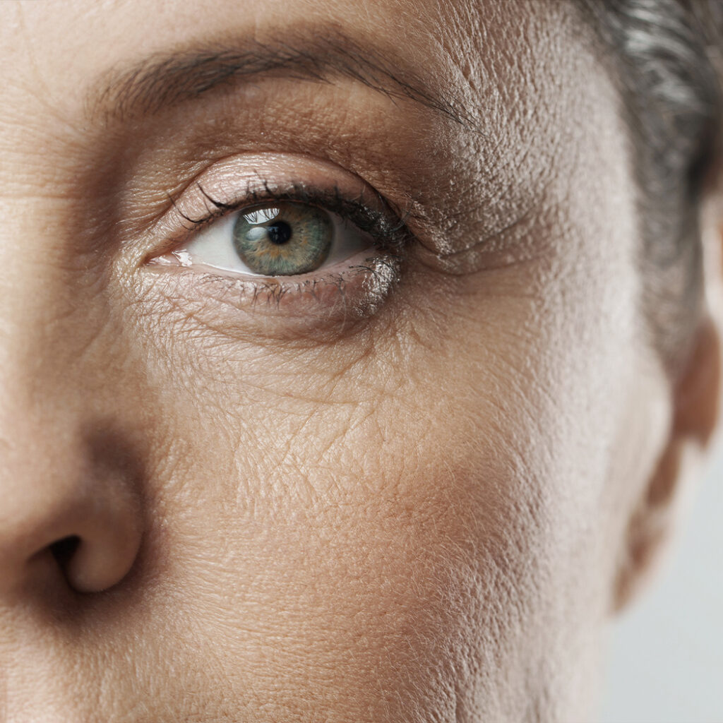 Photo of a woman's eye and facial wrinkles