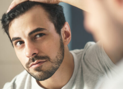 Photo of a man checking his hairline for hair growth