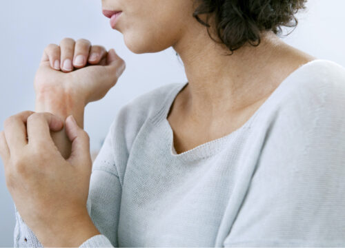 Photo of a woman scratching her wrist