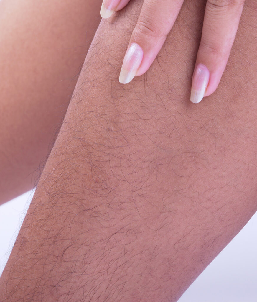 Photo of hair on a woman's leg