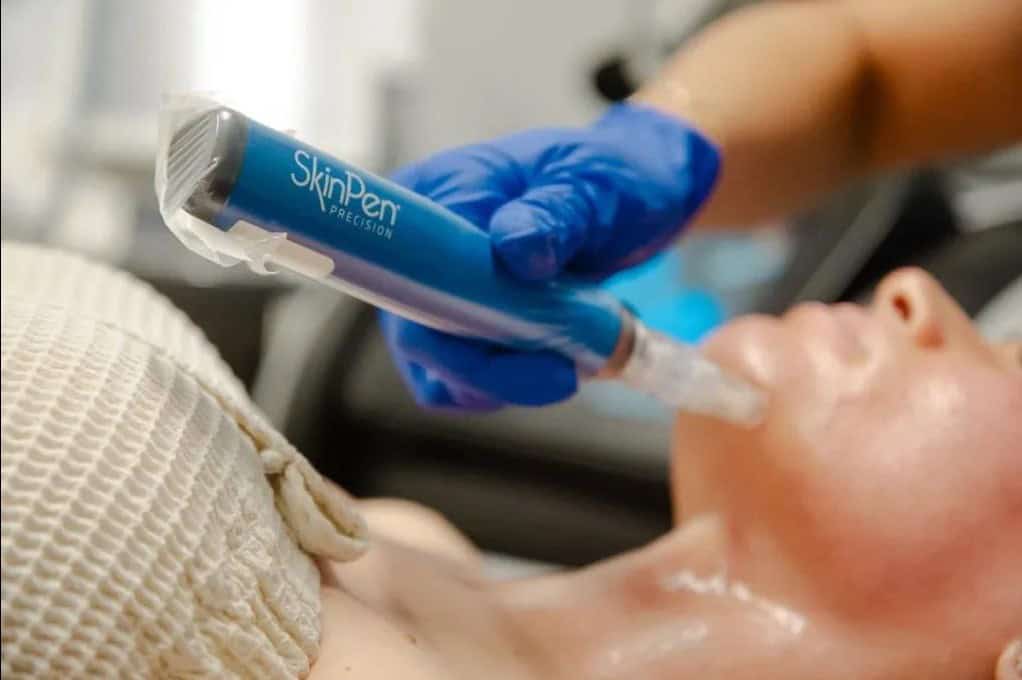 skinpen 2