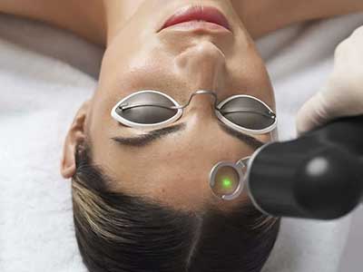 Person lying down with protective goggles while receiving a laser treatment on the forehead from a gloved hand holding a laser device.