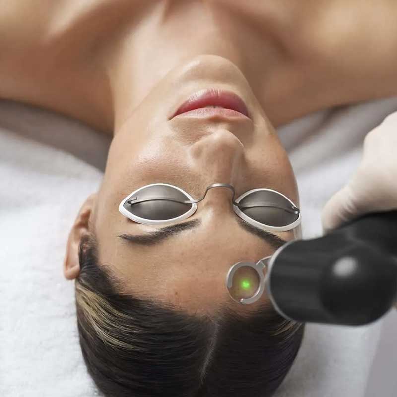 A person wearing protective goggles receives a laser treatment on their forehead from a gloved technician.