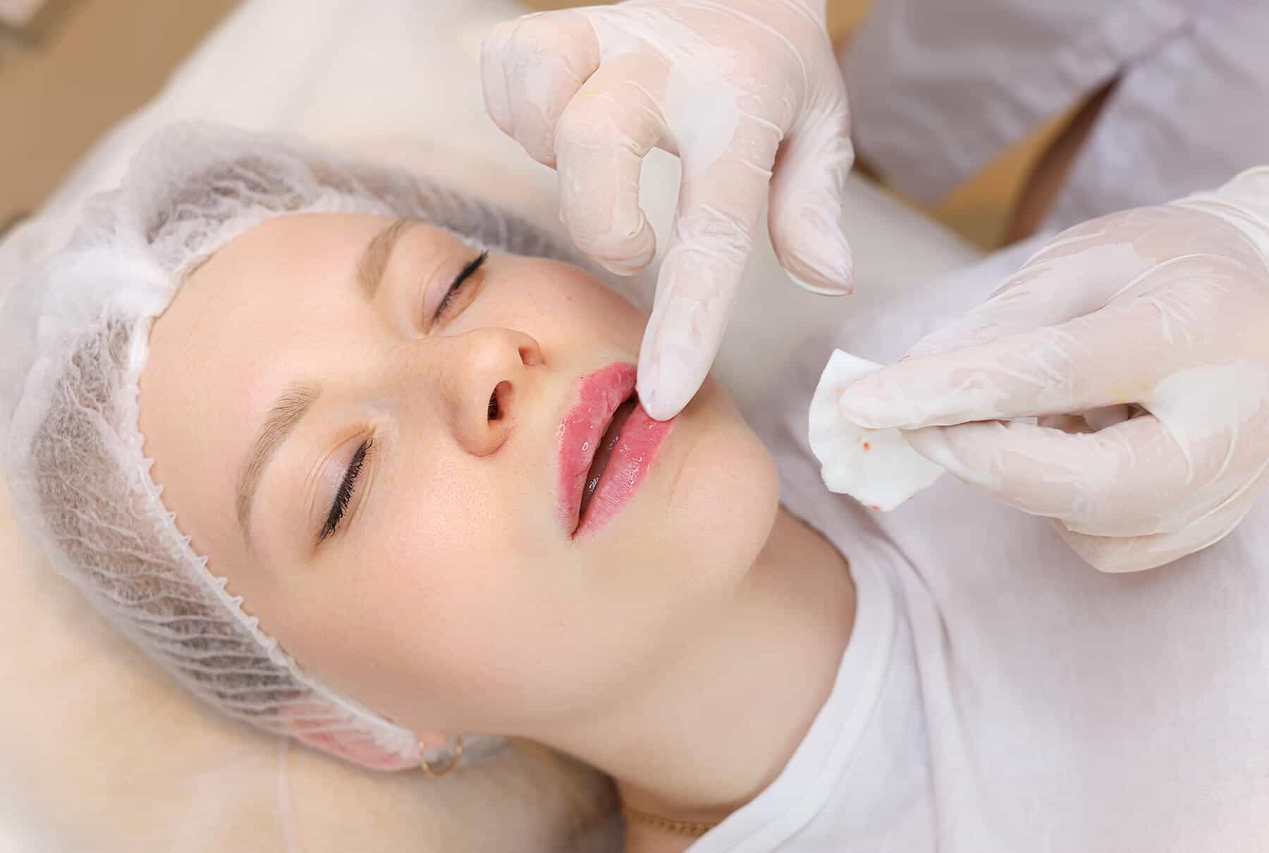 A person wearing a hair cover lies with closed eyes while a gloved professional applies a treatment to their lips using a cotton pad.