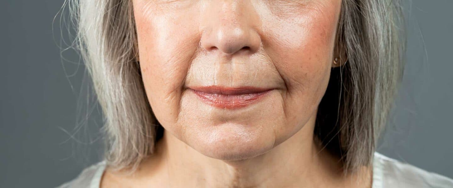 Posh Reno Collagen Loss - POSH Medical Spa and Salon