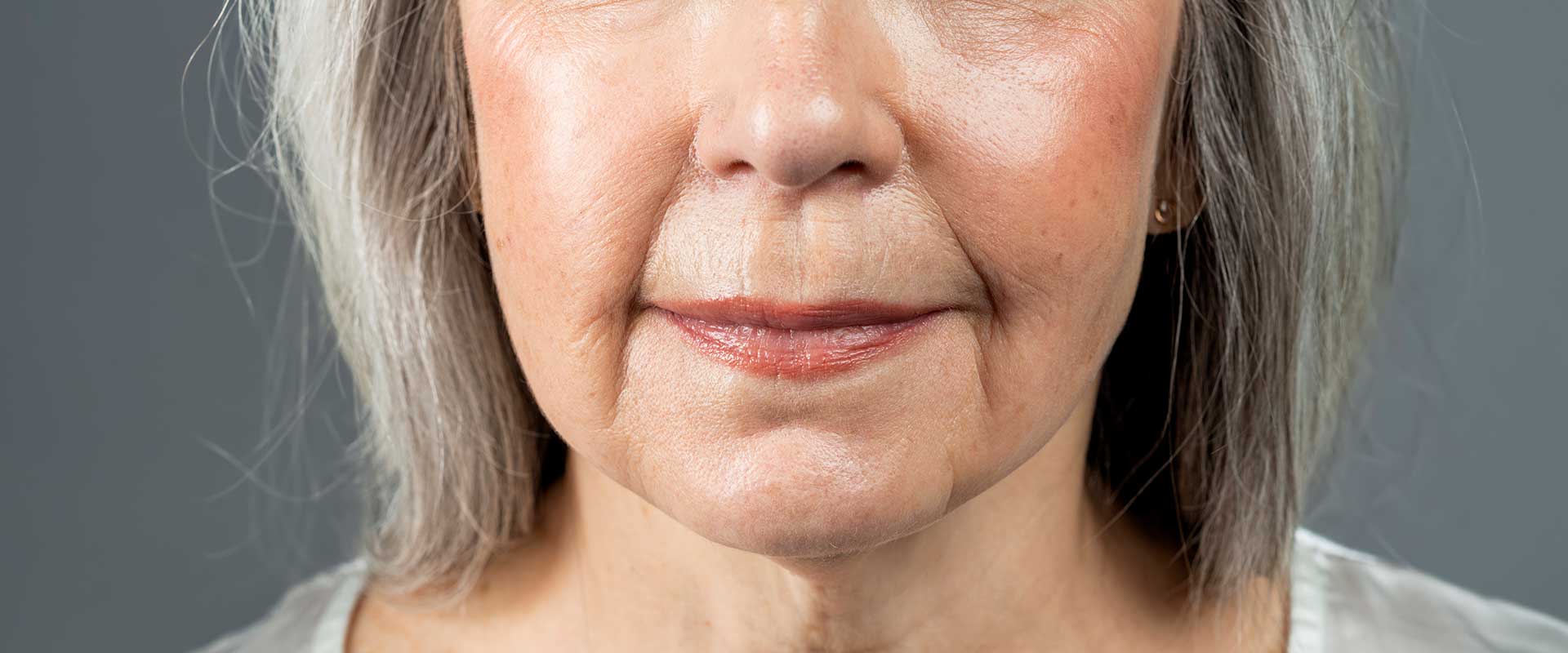 Close-up of the lower face of an older woman with gray hair, neutral expression, and visible signs of aging and collagen loss on her skin.