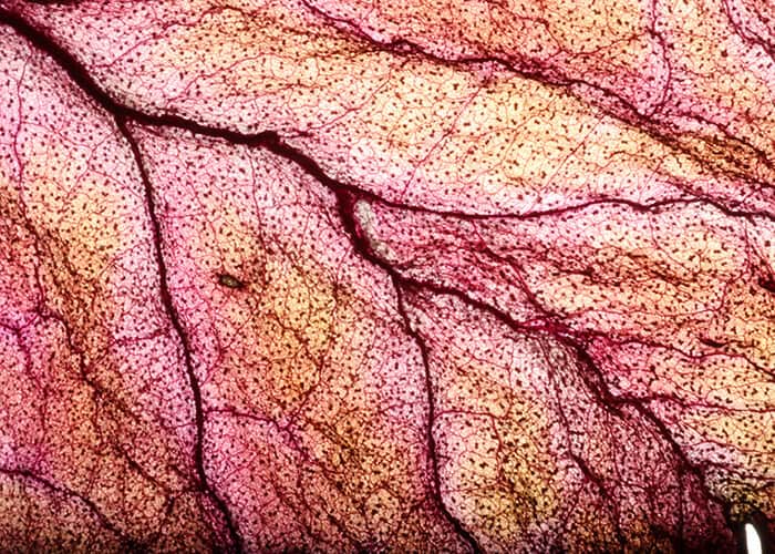 Close-up of a leaf showing pink and yellow hues, with visible veins resembling spider veins and a textured surface under magnification.