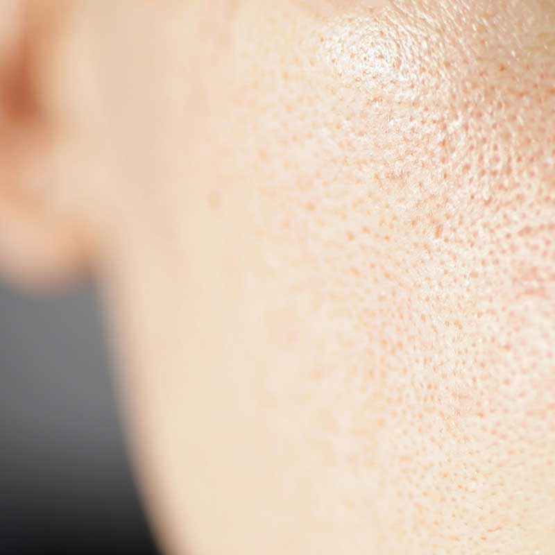 Close-up of human skin showing visible pores and natural texture.