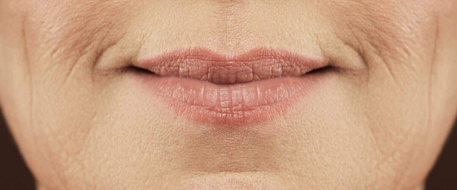 Posh Reno Loss of Facial Volume - POSH Medical Spa and Salon