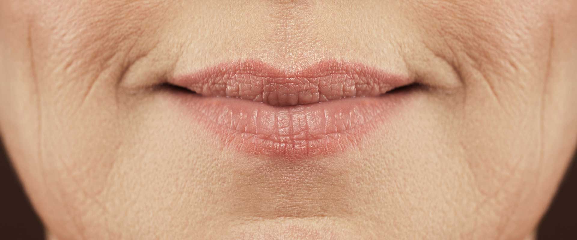 Close-up of a person's mouth with closed lips, showing natural skin texture and fine lines around the lips, which may be early signs of facial volume loss.