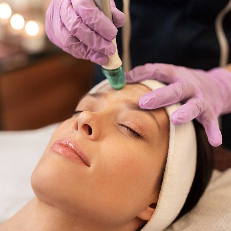 A person with closed eyes receives a Potenz facial treatment using a handheld device, while wearing a white headband. The procedure is performed by someone in purple gloves.