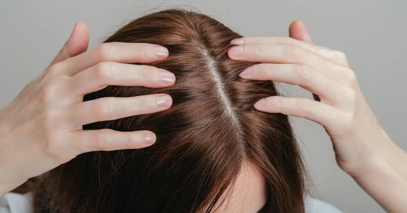 scalp hair two
