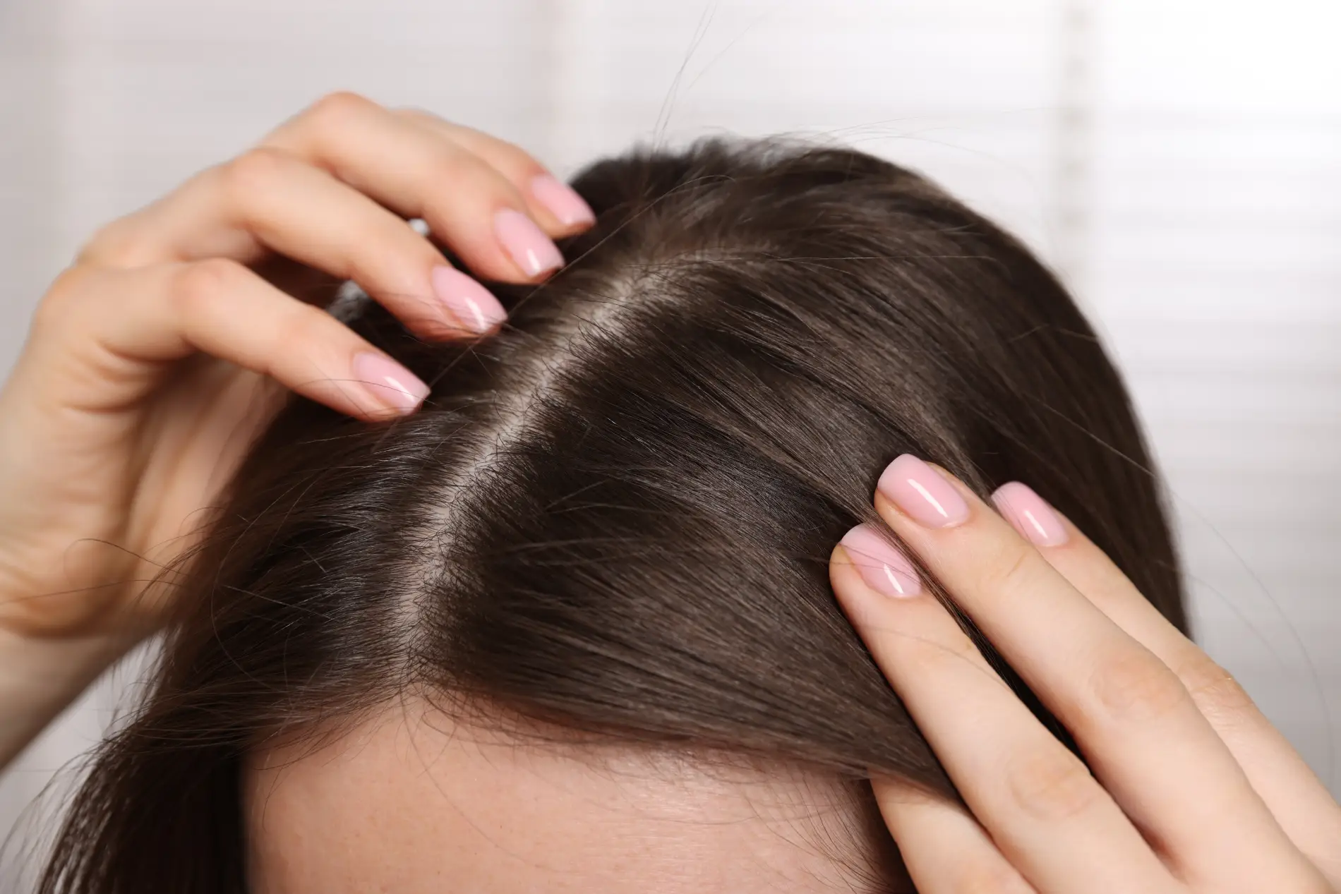 scalp hair