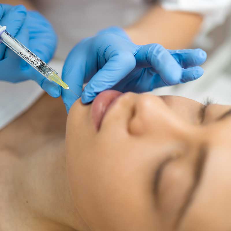 A person receives Sculptra fillers in the chin area from a medical professional wearing blue gloves.