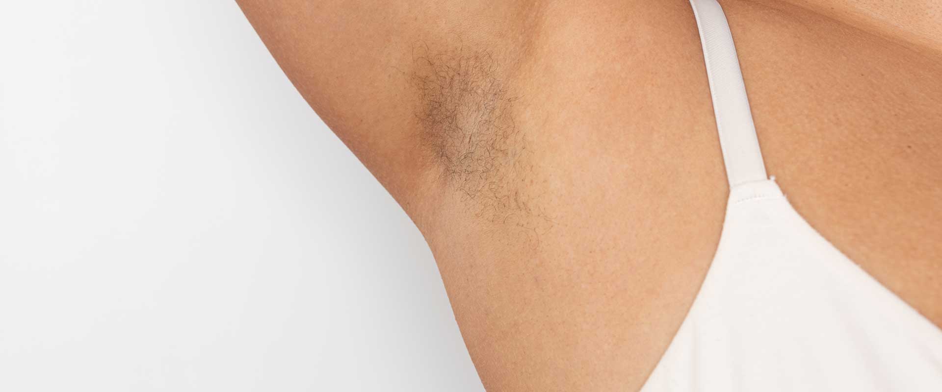 A close-up of a person's armpit with visible hair growth, wearing a white sleeveless top—perfect for showcasing Hair Removal or Unwanted Hair Removal results.
