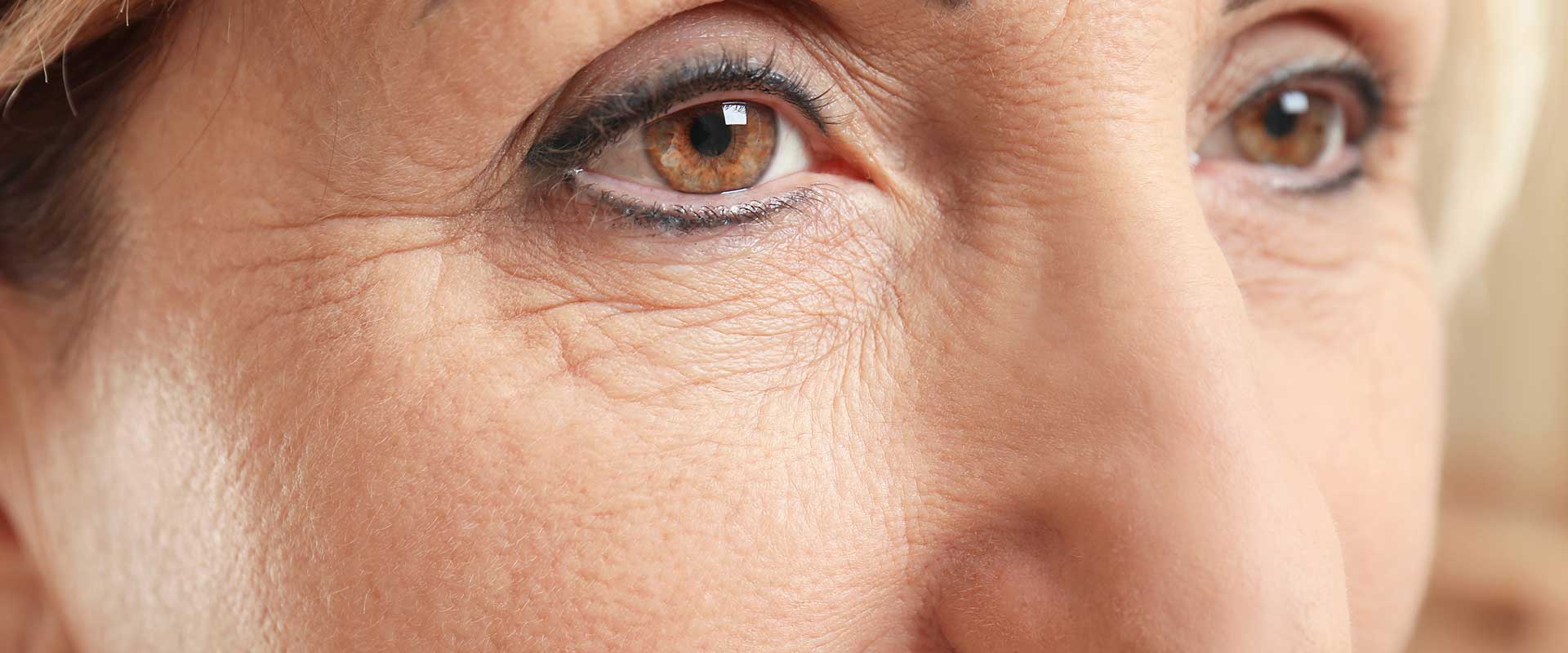 Close-up of an older woman's face, focusing on her eyes and highlighting fine lines and wrinkles around the eye area.
