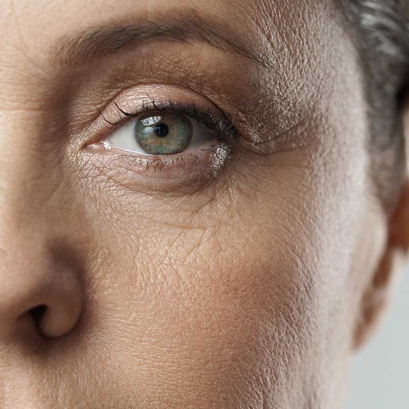Close-up of the left side of a middle-aged person's face, focusing on the eye area with visible fine lines and wrinkles.